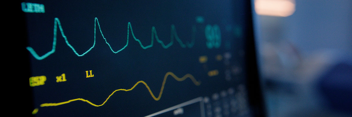 Close up of vital signs on a screen