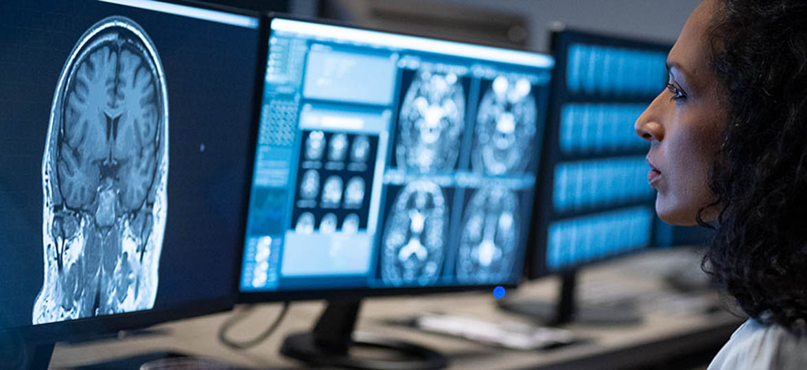 Close-up of a radiologist analyzing an MRI scan