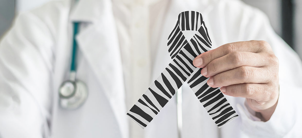 A close up of a doctor's hand holding a zebra print ribbon representing EDS